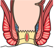 치열